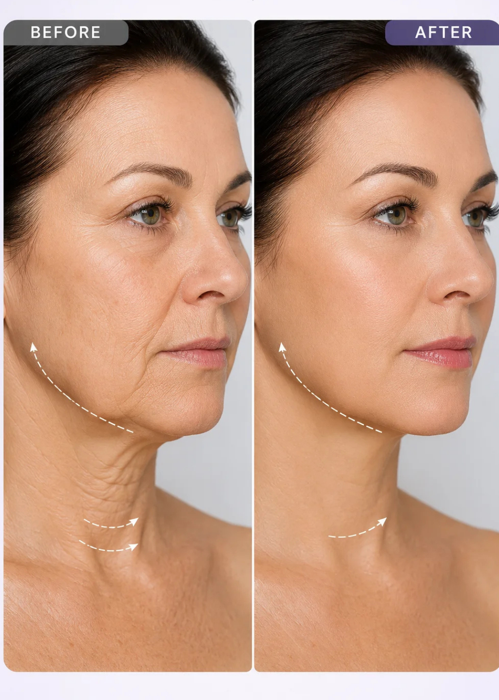 Improves Skin Tightness