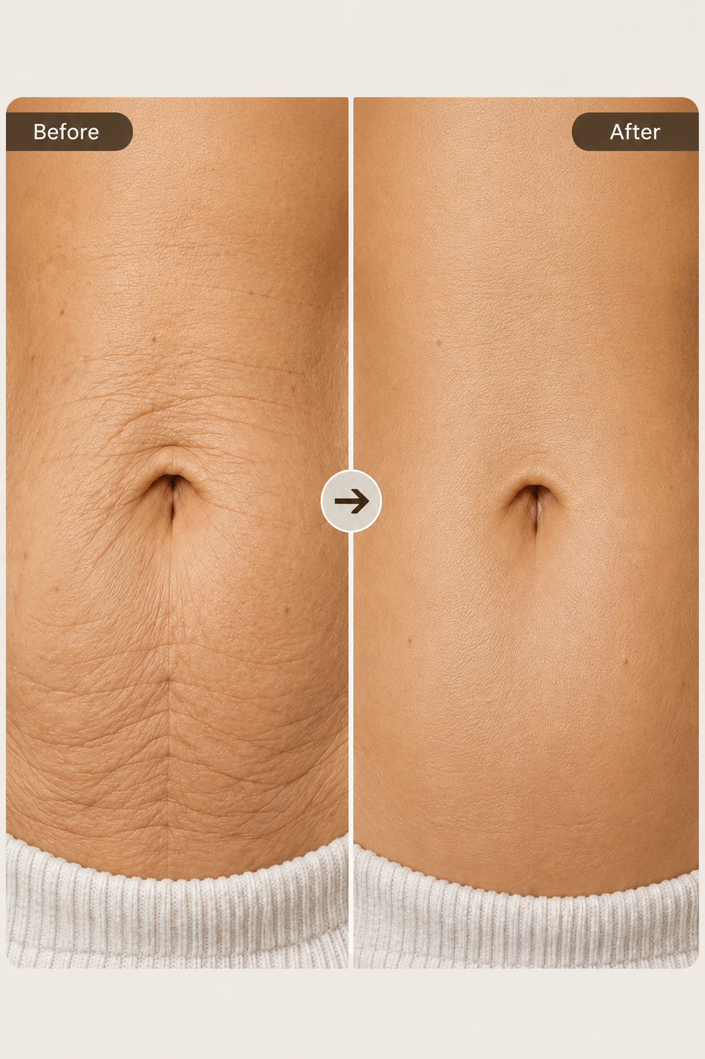 Tightens & Tones